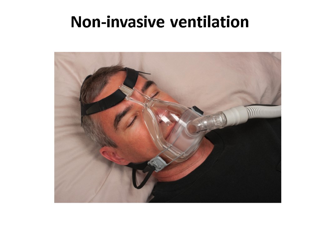 Non-invasive ventilation